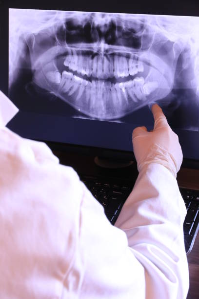 Best Emergency Dental Surgery in East Pepperell, MA