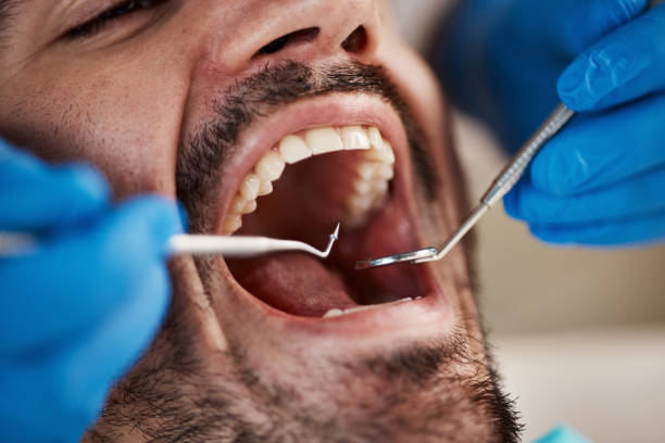 Best After-Hours Emergency Dentist in East Pepperell, MA